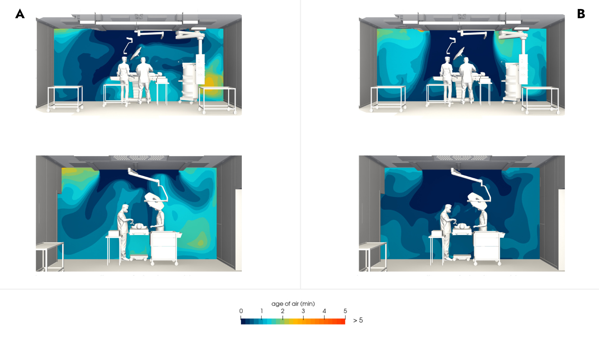 Operating theatre ventilation configuration comparison